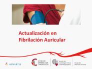 Actualizaciуn en Fibrilaciуn Auricular