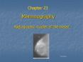 Mammography PowerPoint PPT Presentation