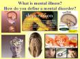 What is mental illness? How do you define a mental disorder? PowerPoint PPT Presentation