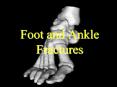 Foot and Ankle Fractures PowerPoint PPT Presentation