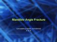 Mandible Angle Fracture PowerPoint PPT Presentation