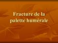 Fracture de la palette hum PowerPoint PPT Presentation