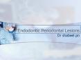 Endodontic Periodontal Lesions PowerPoint PPT Presentation