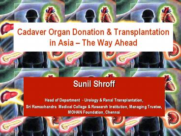 Cadaver Organ Donation