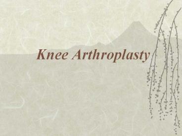 Knee Arthroplasty