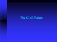 The Cleft Palate Case Study Full term infant, NSVD PowerPoint PPT Presentation