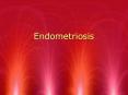 Endometriosis PowerPoint PPT Presentation