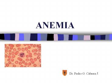 ANEMIA