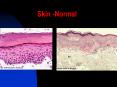 Skin -Normal Skin -Normal Stratified Squamous epithelial PowerPoint PPT Presentation