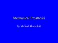 Mechanical Prosthesis PowerPoint PPT Presentation