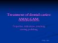 Treatment of dental caries: AMALGAM. PowerPoint PPT Presentation