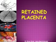 RETAINED PLACENTA