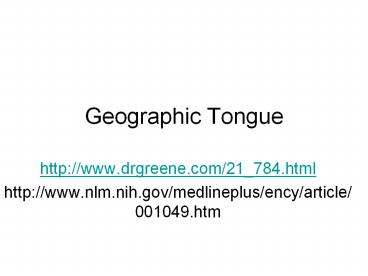 Geographic Tongue