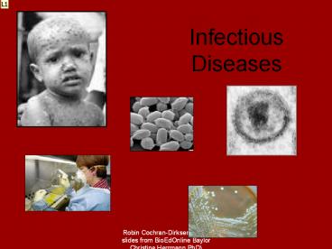 Infectious Diseases