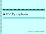 ECG Dysrhythmias