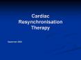Cardiac Resynchronisation Therapy PowerPoint PPT Presentation
