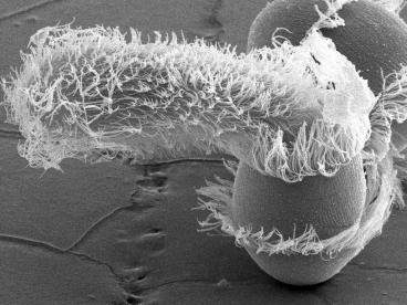 The Origins of Eukaryotic Diversity 