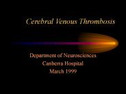 Cerebral Venous Thrombosis