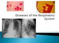 Diseases of the Respiratory System PowerPoint PPT Presentation