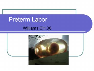 presentation player overlay