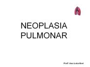 NEOPLASIA PULMONAR