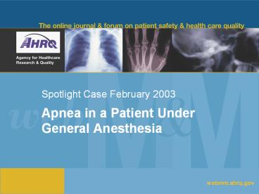 Spotlight Case February 2003
