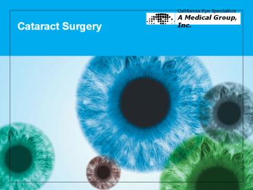 Cataract Surgery