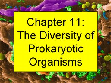 Chapter 11: The Diversity of Prokaryotic Organisms