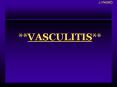 **VASCULITIS** PowerPoint PPT Presentation
