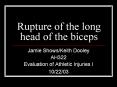 Rupture of the long head of the biceps PowerPoint PPT Presentation