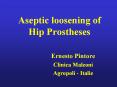 Aseptic loosening of Hip Prostheses PowerPoint PPT Presentation