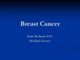 Breast Cancer PowerPoint PPT Presentation