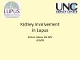 Kidney Involvement in Lupus PowerPoint PPT Presentation