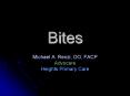 Bites PowerPoint PPT Presentation