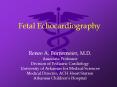 Fetal Echocardiography PowerPoint PPT Presentation