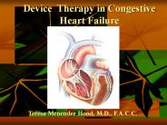 Device Therapy in Congestive Heart Failure