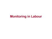 Monitoring in Labour
