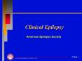 Clinical Epilepsy PowerPoint PPT Presentation