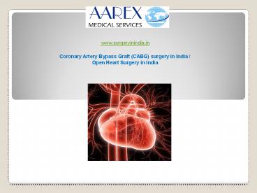 Coronary Artery Bypass Graft (CABG) surgery in India / Open Heart Surgery in India