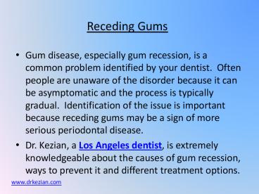 Receding Gums 10-22