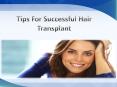 Tips For Hair Transplant in india PowerPoint PPT Presentation