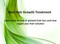 Best Hair Growth Treatment PowerPoint PPT Presentation