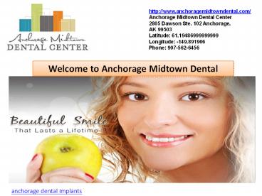 dental implants anchorage