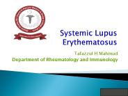 SLE pathphysiology and treatment targets