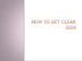 How to get clear skin PowerPoint PPT Presentation