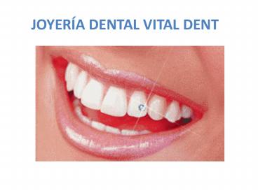 Vitaldent con la joyeria dental, piercing y diamantes