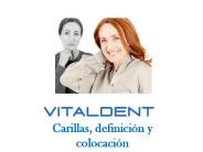Vitaldent y las carillas dentales