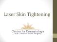 Laser Skin Tightening PowerPoint PPT Presentation