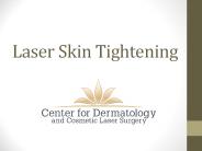 Laser Skin Tightening