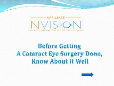 Before Getting A Cataract Eye Surgery Done,